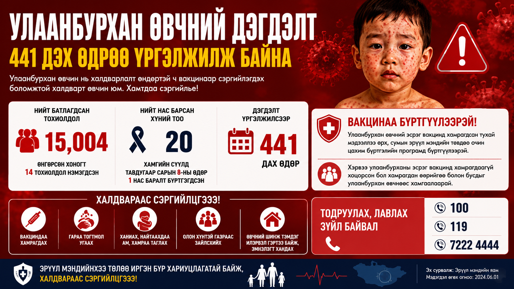 “KIZAMIK SALGINI 441 GÜNDÜR DURDURULAMIYOR”MOĞOLİSTAN’DA VAKA SAYISI 15 BİNİ AŞTI, CAN KAYBI ARTIYOR